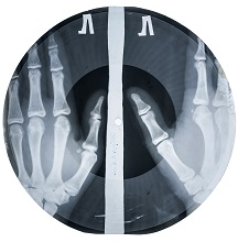 TRIESTE FILM FESTIVAL 28 - L'incredibile storia segreta degli X-RAY AUDIO